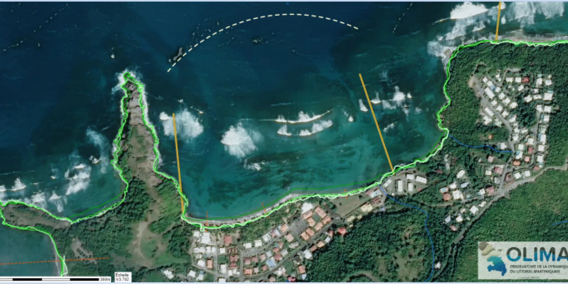 Anse l'étang (1951-2019) - © BRGM Anse Etang (avant/après)